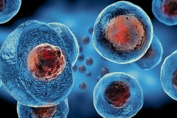 Best Stem Cell Therapy Puerto Vallarta