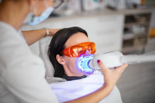 Teeth Whitening in Riyadh