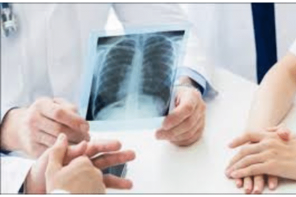 X-Ray OPG Services in Bengaluru
