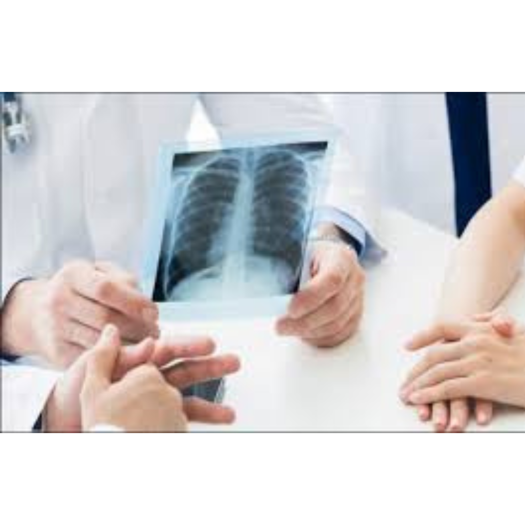 X-Ray OPG Services in Bengaluru
