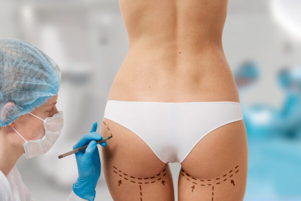 Brazilian Butt Lift Surgery