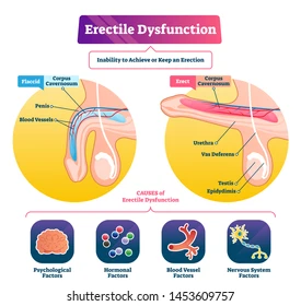 Duratia 60 mg has become a trusted medication for men struggling with premature ejaculation (PE). Its active ingredient, dapoxetine hydrochloride, is a short-acting SSRI designed for on-demand use before sexual activity.