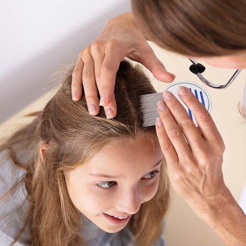 Head Lice Check