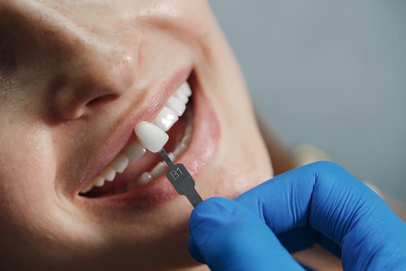 Best dentist for TMJ Dubai